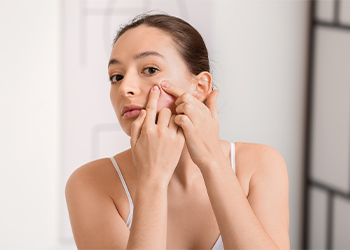 5 Cosas que debes evitar si tienes piel con impurezas